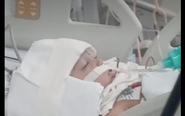 Criança de 11 meses atropelada por motoqueiro está em coma induzido