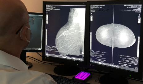 Hospital das Clínicas recebe equipamento de mamografia contrastada