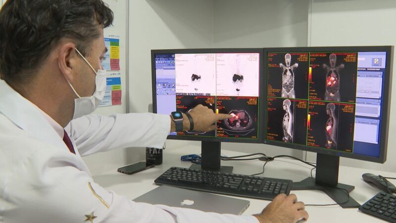 Câncer de próstata tem novo tratamento com radioterapia reduzida